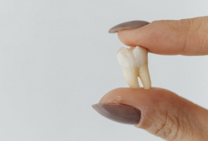 RN TEM BANCO DE DENTES HUMANOS E VOCÊ PODE SER UM DOADOR; ENTENDA