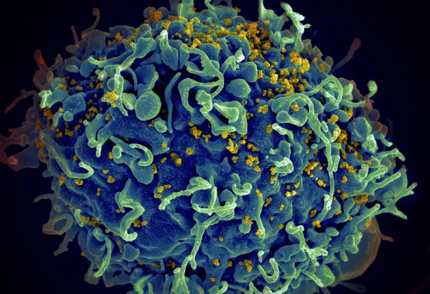 HIV: CIENTISTRAS ANUNCIAM 7º PACIENTE CURADO APÓS TRANSPLANTE DE MEDULA ÓSSEA CUJO DOADOR ERA RESISTENTE AO VÍRUS