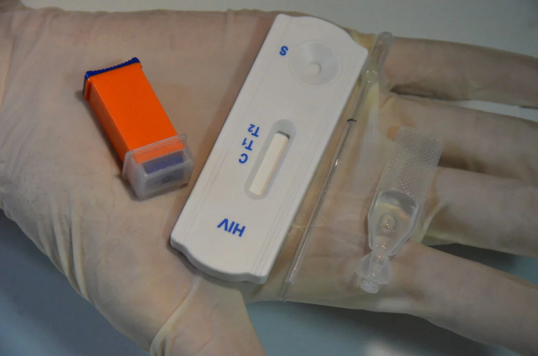 NÚMERO DE PESSOAS COM HIV AUMENTA 98%  EM 10 ANOS NO RN
