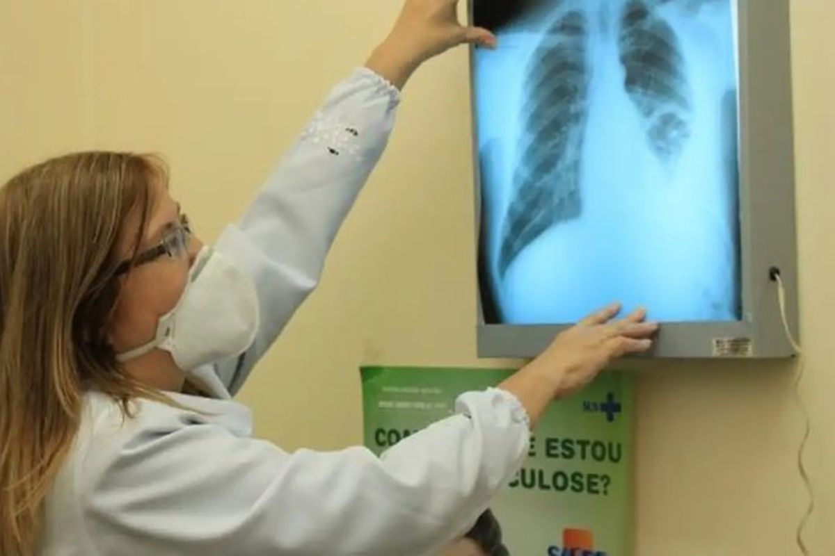 BRASIL AMPLIA TRATAMENTO PREVENTIVO E COMBATE  À TUBERCULOSE COM FOCO EM INOVAÇÃO E INTERSETORIALIDADE