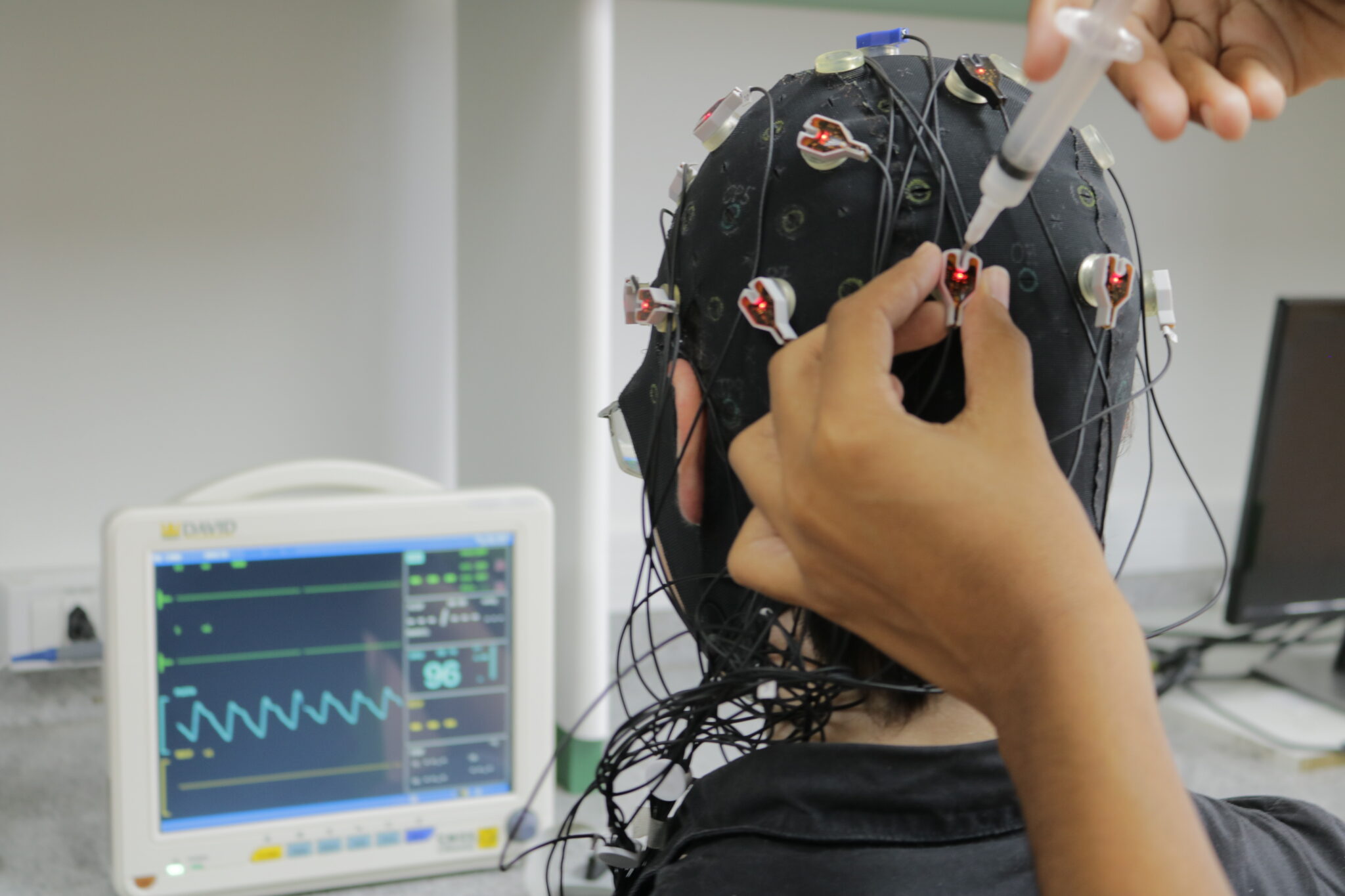 ISD ABRE INSCRIÇÕES PARA O MESTRADO EM NEUROENGENHARIA