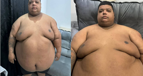 COM 25O KG, CANTOR GUERRA NETO LUTA CONTRA OBESIDADE; SAIBA COMO AJUDAR