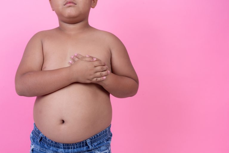 ÍNDICE DE OBESIDADE INFANTIL  NO RN É SUPERIOR ÀS MÉDIAS NACIONAL E DO NORDESTE