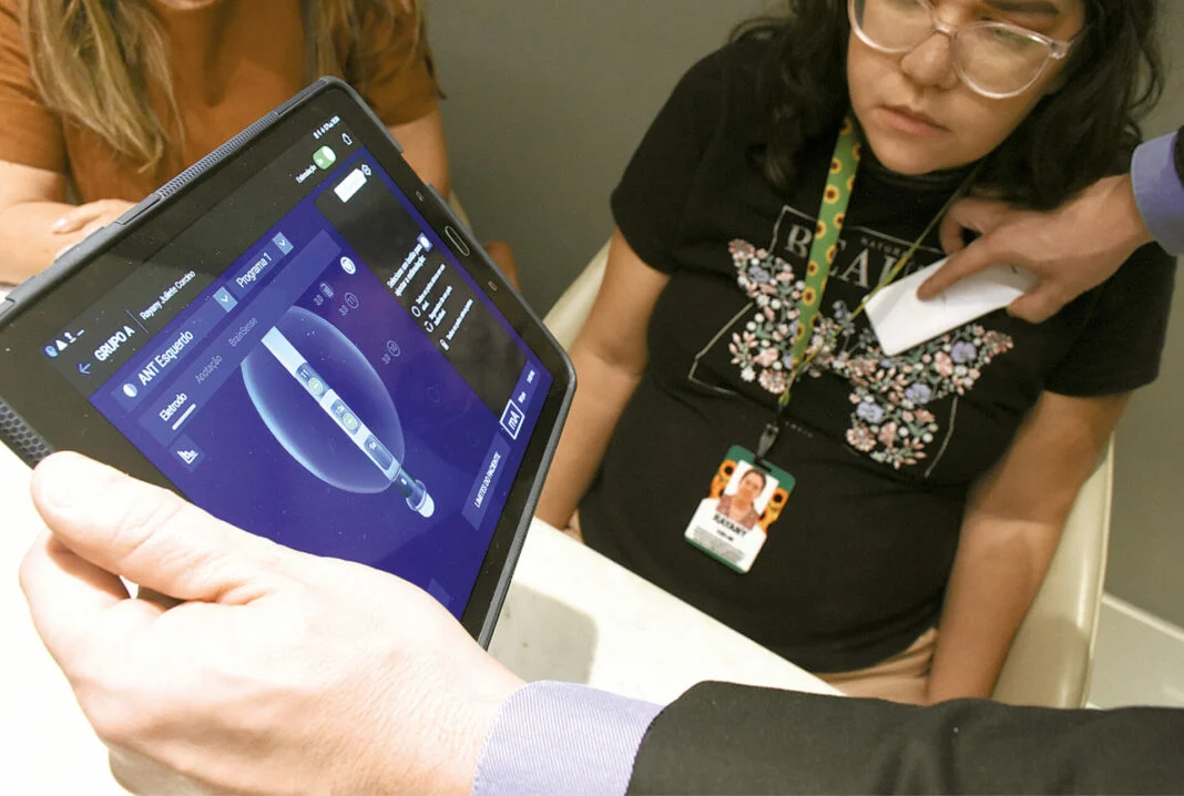 IMPLANTE CEREBRAL PROMETE REDUZIR CRISE DE EPILEPSIA EM 50%