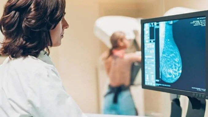 CASOS DE CÂNCER EM PESSOAS COM ATÉ 50 ANOS CRESCEM 284% EM 11 ANOS NO BRASIL, APONTA DATASUS