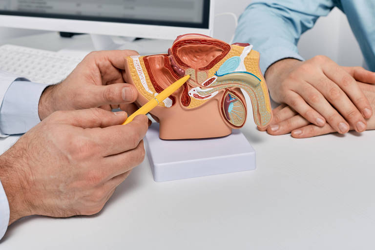 CÂNCER DE PRÓSTATA AINDA MATA 48 HOMENS POR DIA NO BRASIL, MESMO COM ALTAS CHANCES DE CURA