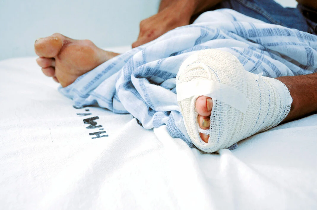 DIABETES CAUSA MAIS DE 2,5 MIL AMPUTAÇÕES NO RN E ACENDE ALERTA