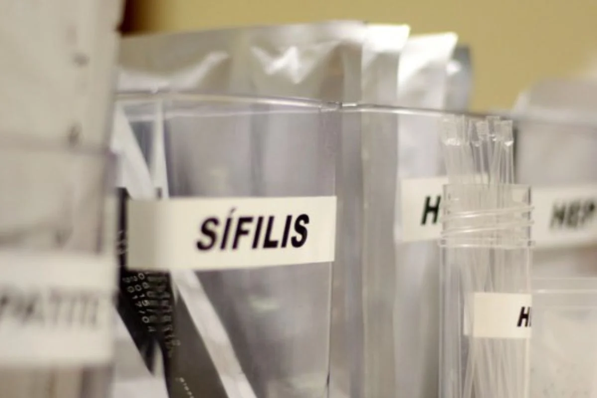 CASOS DE SÍFILIS CRESCE NO BRASIL E PREOCUPA AUTORIDADES DE SAÚDE