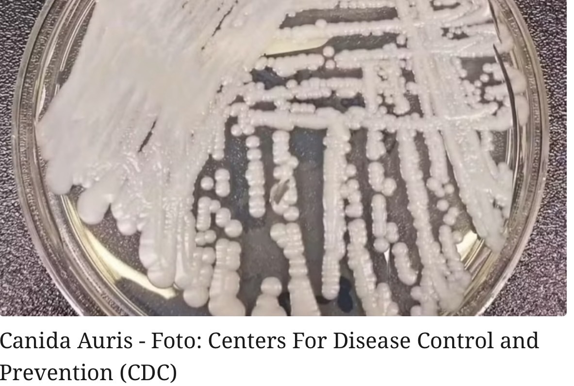 RN CASO DE SUPERFUNGO EM PACIENTE INTERNADO EM NATAL