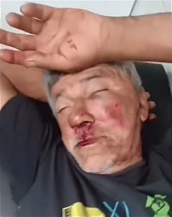 [VÍDEO] IDOSO É AGREDIDO COM CORONHADAS POR VIGIA DE UBS EM NOVA CRUZ-RN