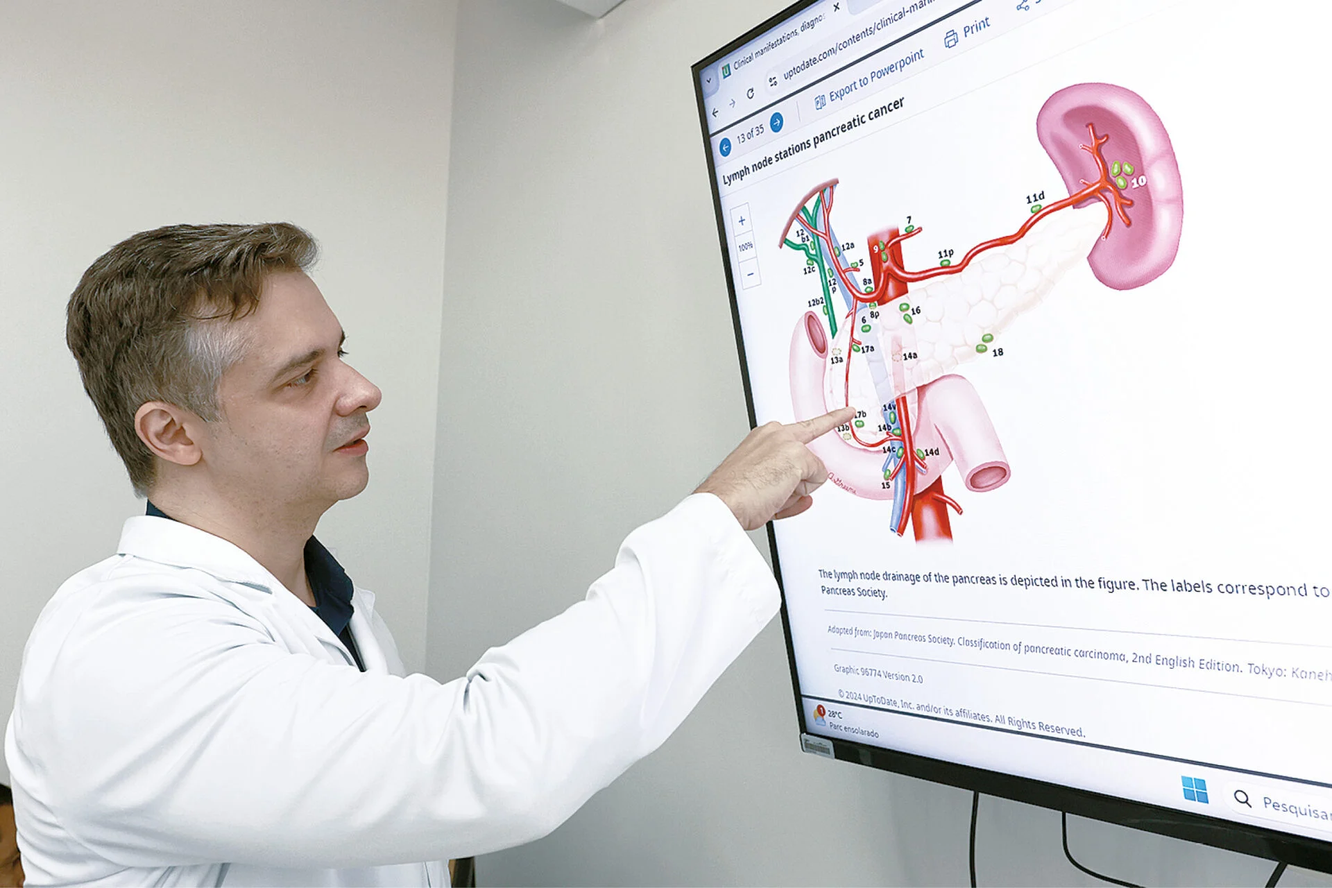 NOVO COMPRIMIDO PODE DOBRAR A SOBREVIDA DE PACIENTES COM CÂNCER DE PÂNCREAS METASTÁTICO